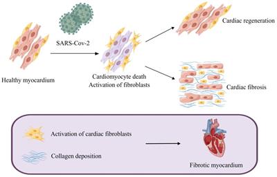 Possible mechanisms of SARS-CoV-2-associated myocardial fibrosis: reflections in the post-pandemic era